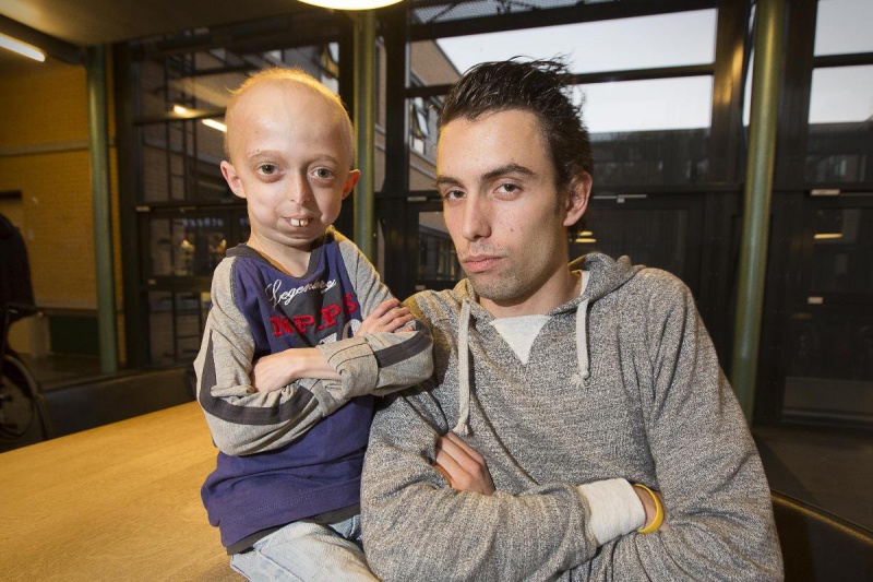 \"Nijmegen, 15-11-2012 . VOX, Michael doet vrijwiliggerswerk met kinderen met Progeria, ouderdomsziekte.\"